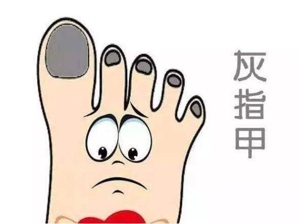 图片[1]-如何判断灰指甲是否好转？-草根创业生活网