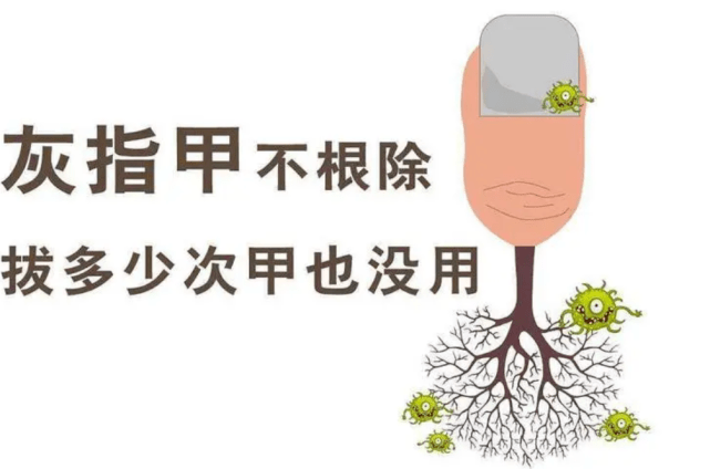 图片[1]-如何改善灰指甲呢？-草根创业生活网