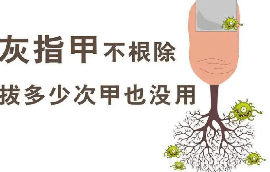 图片[1]-灰指甲会传染给婴儿吗?-草根创业生活网