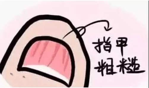 图片[2]-美甲会的得灰指甲吗?-草根创业生活网