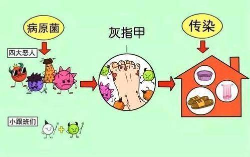 图片[1]-防治“灰指甲”怎么做？-草根创业生活网