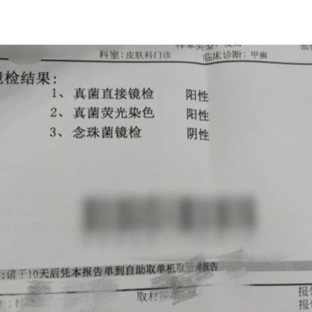 图片[2]-重度灰指甲必看！康复者教你一个简单方法，在家轻松摆脱丑指甲！-草根创业生活网