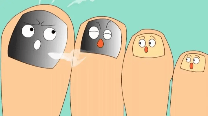 图片[1]-容易得灰指甲的五类人都在这里了!-草根创业生活网