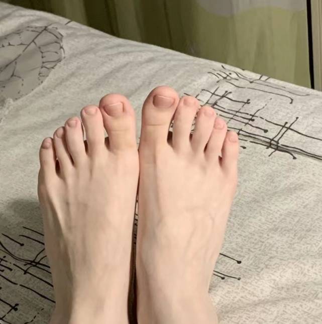 图片[4]-指甲发黄增厚剪不动？过来人教你这几招，轻松在家清除顽固灰指甲-草根创业生活网