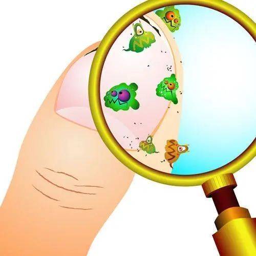 图片[2]-灰指甲是怎么得来的？-草根创业生活网