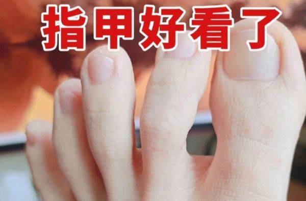 图片[1]-灰指甲是怎么得来的？-草根创业生活网