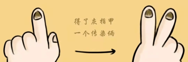 图片[1]-灰指甲是怎么进行传染的-草根创业生活网