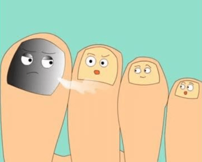 图片[2]-灰指甲有什么危害有什么办法甜制好-草根创业生活网
