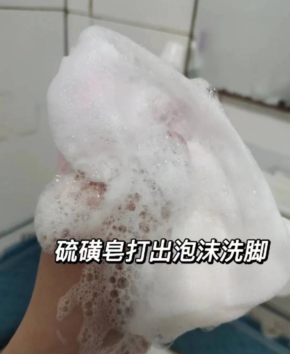 图片[4]-灰指甲除根真不难！每天做到这2点，不出3个月泛黄增厚指甲秒没！-草根创业生活网