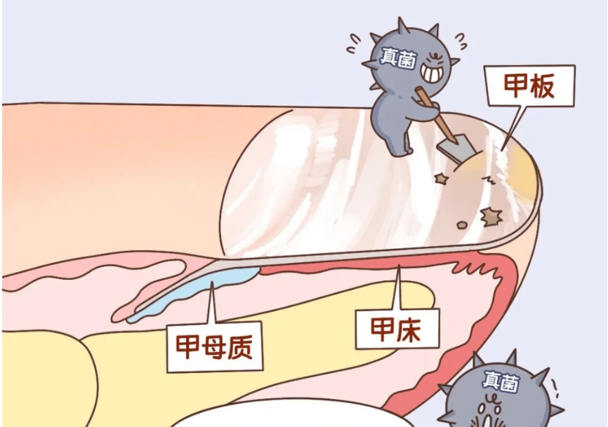 图片[3]-康复者的经验告诉大家：坚持内调外涂真的能好-草根创业生活网