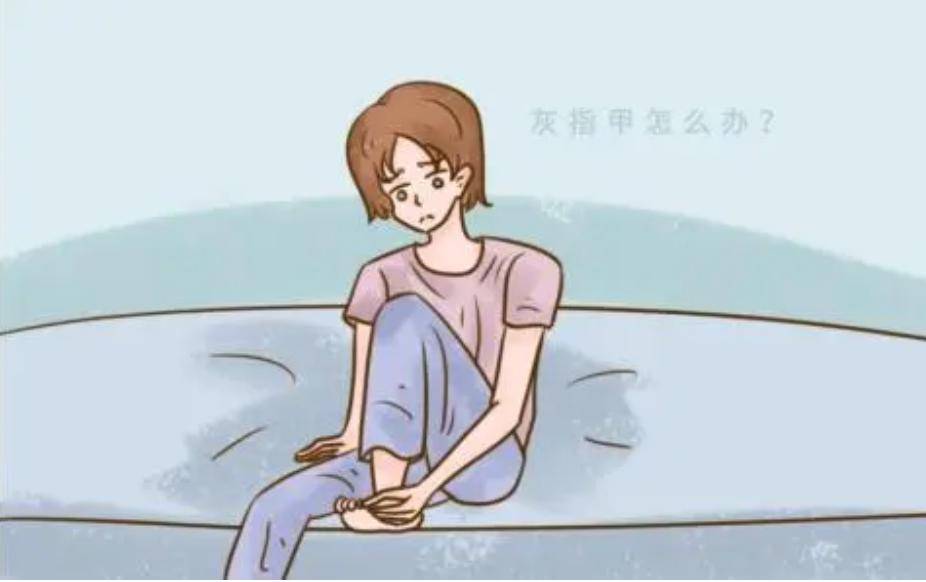 图片[3]-灰指甲怎么治疗除根用什么药？-草根创业生活网