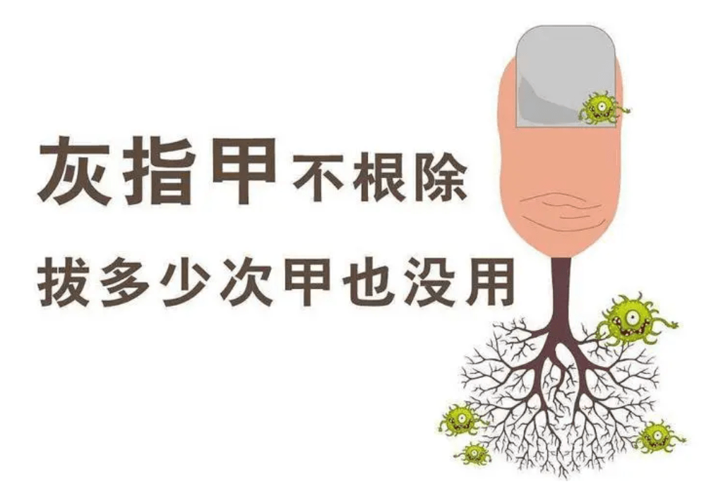 图片[1]-灰指甲是什么原因造成有什么危害？-草根创业生活网