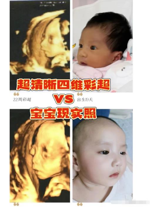 2 130 - 小红书Ai绘画项目解析，不可多得的创业商机